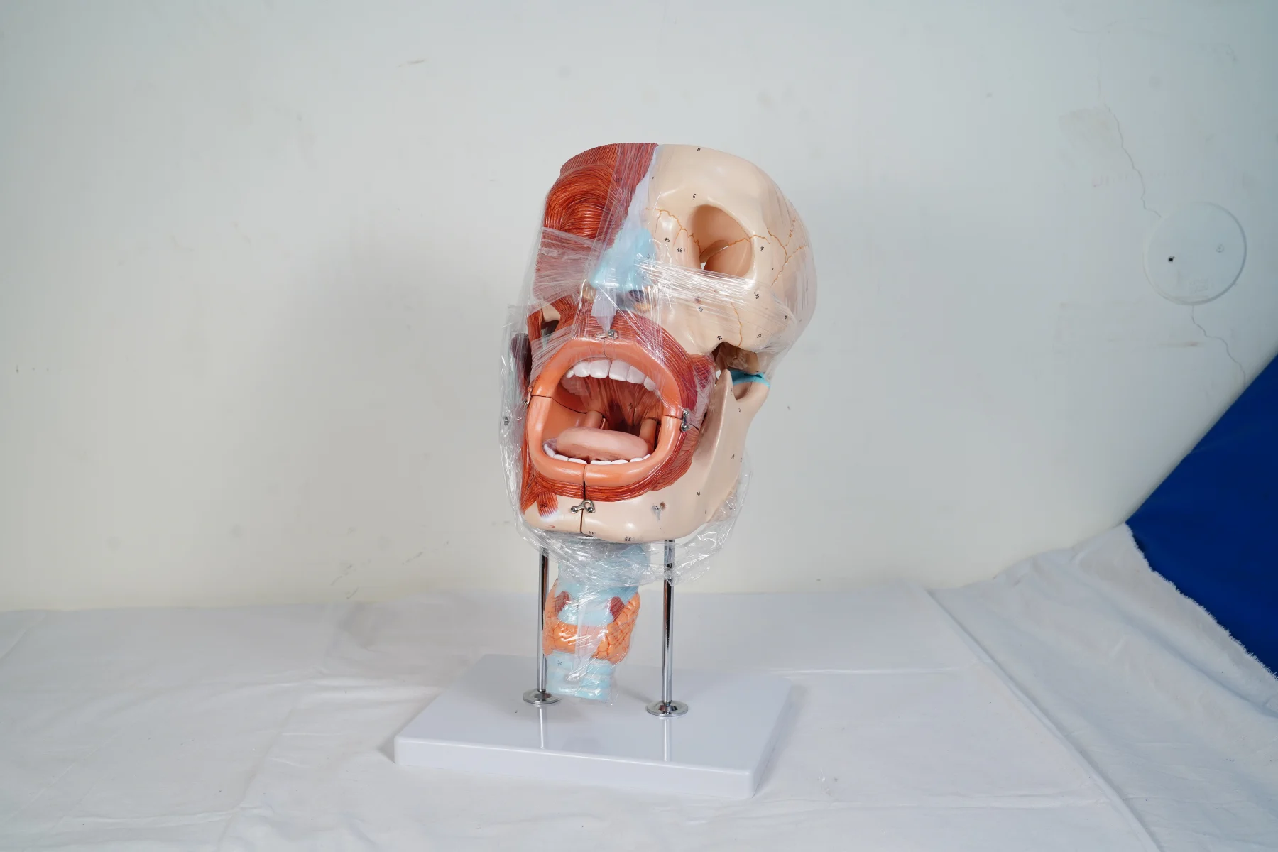 Cavities of Nose Mouth Throat Enlarged