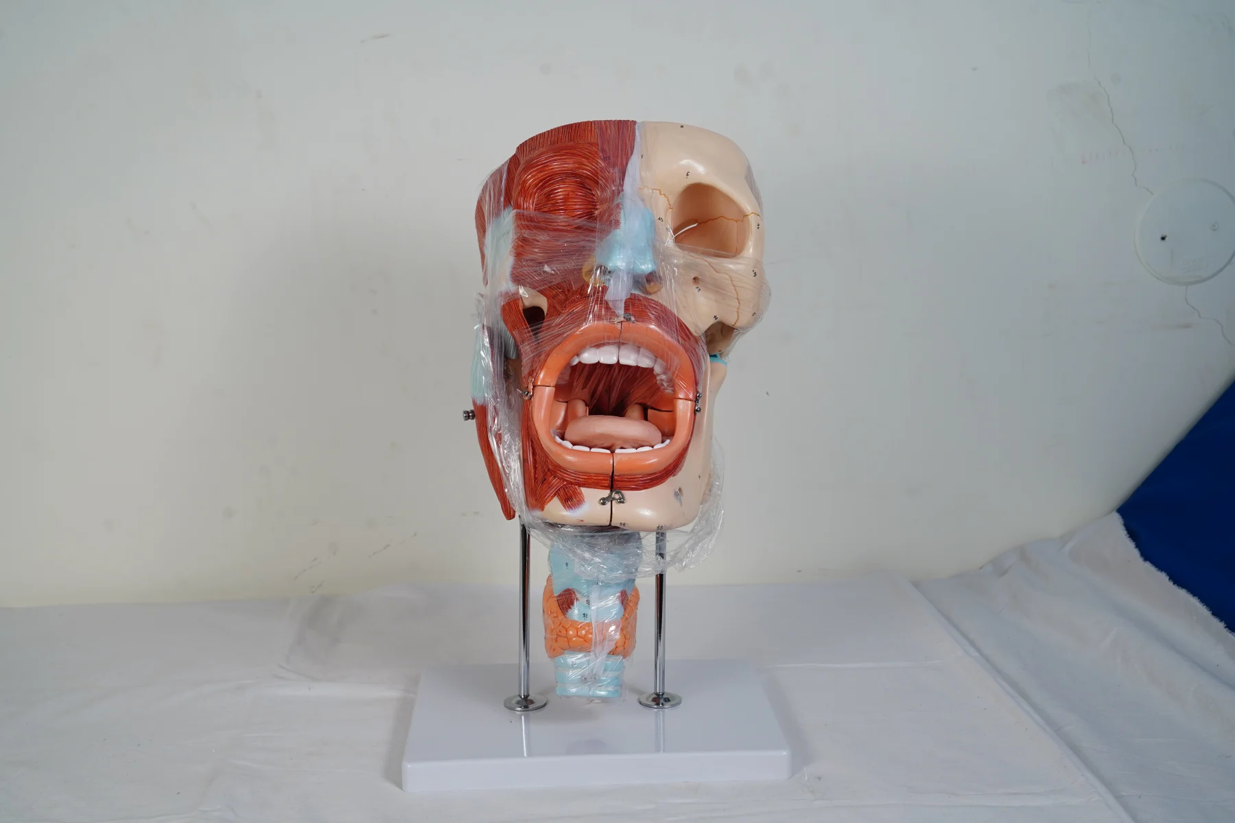 Cavities of Nose Mouth Throat Enlarged thumbnail 4