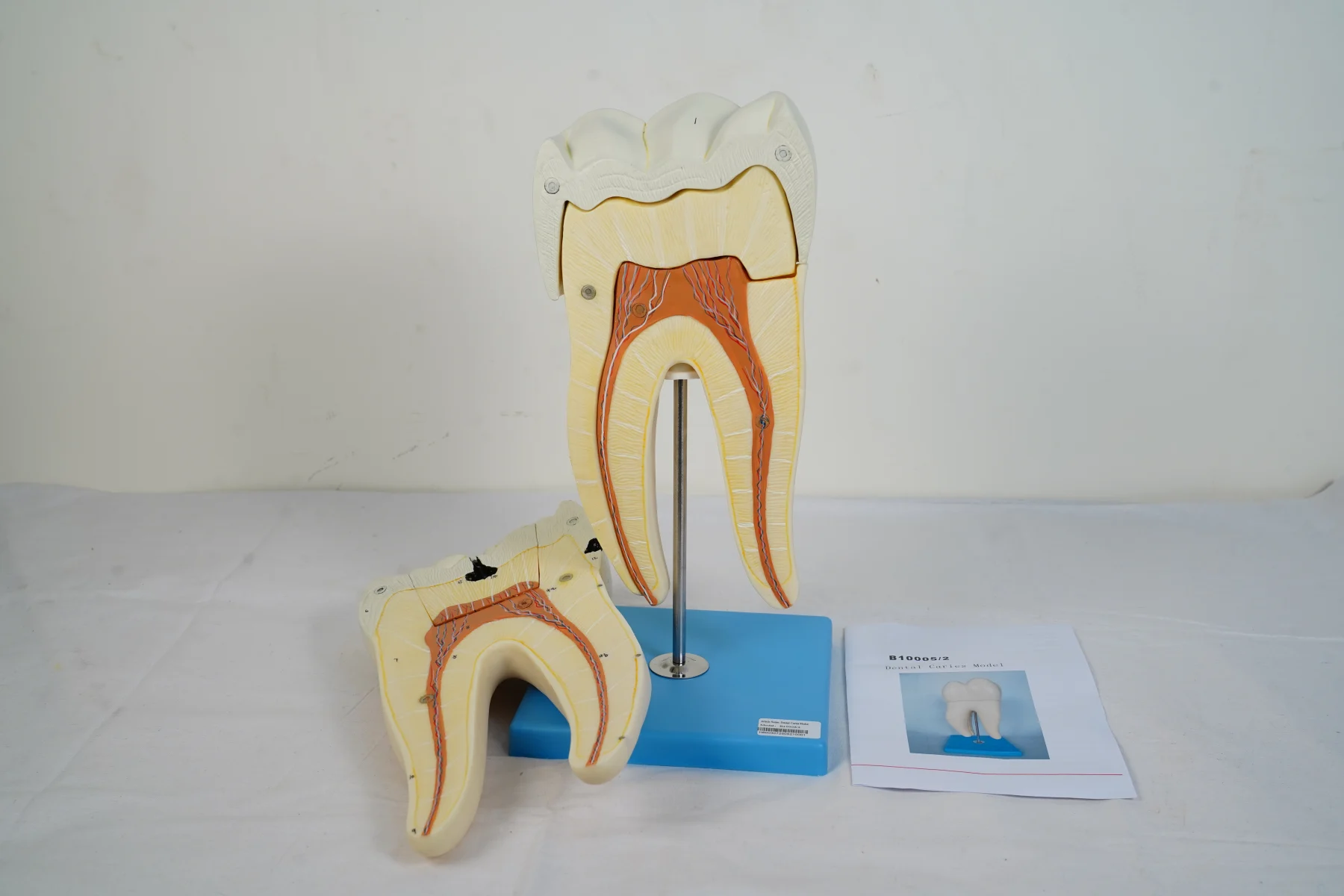 Dental Caries Model thumbnail 3