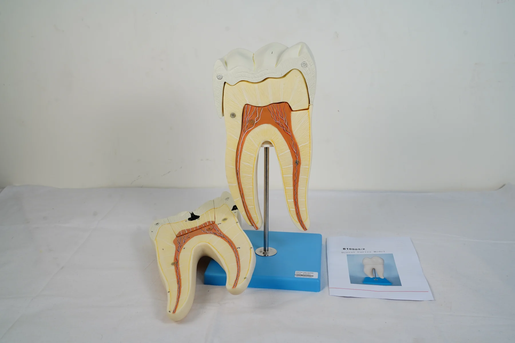 Dental Caries Model thumbnail 4