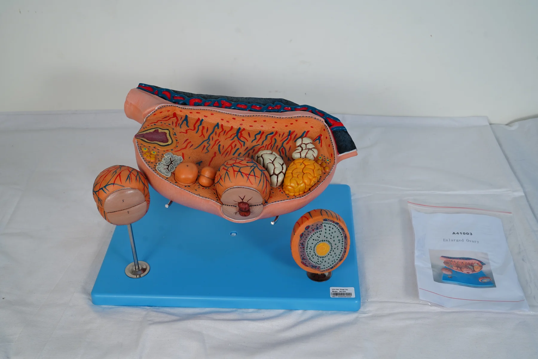 Enlarged Ovary thumbnail 2