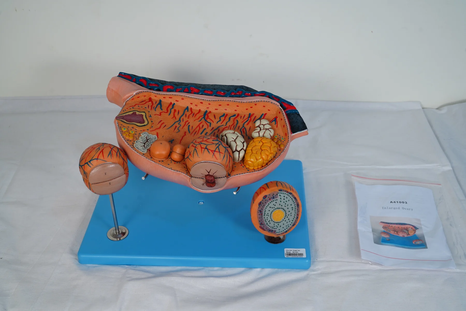 Enlarged Ovary thumbnail 3
