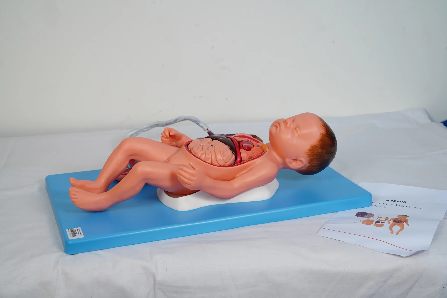 Fetus With Viscus and Placenta