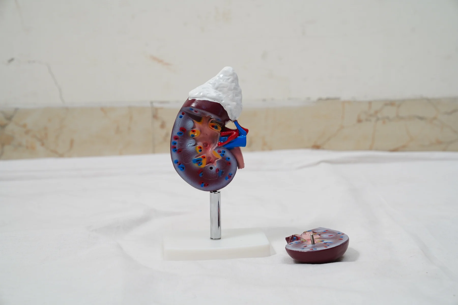 Human Kidney With Adrenal Gland