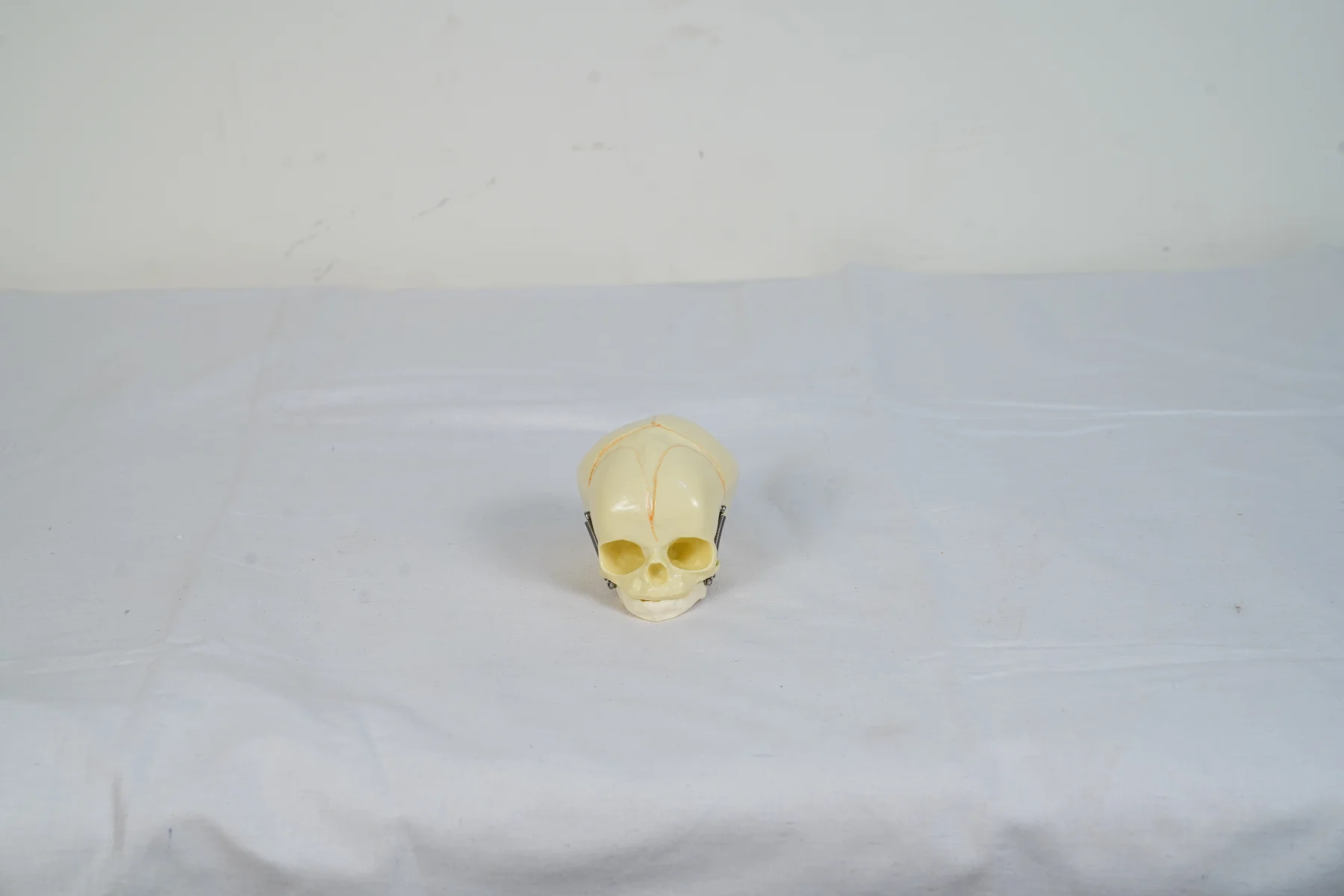 Infant Skull