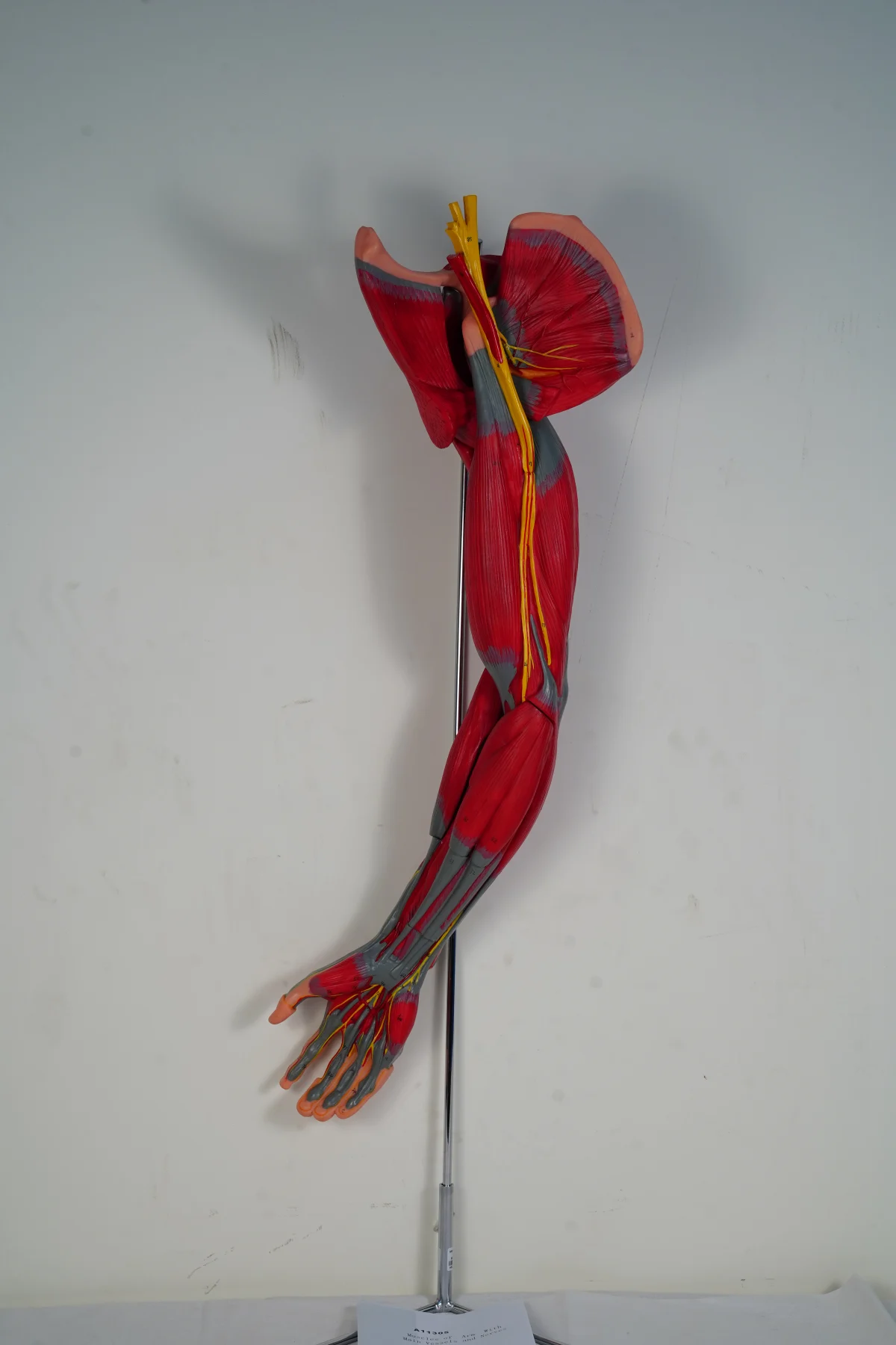 Muscles of Arm With Main Vessels and Nerves thumbnail 9