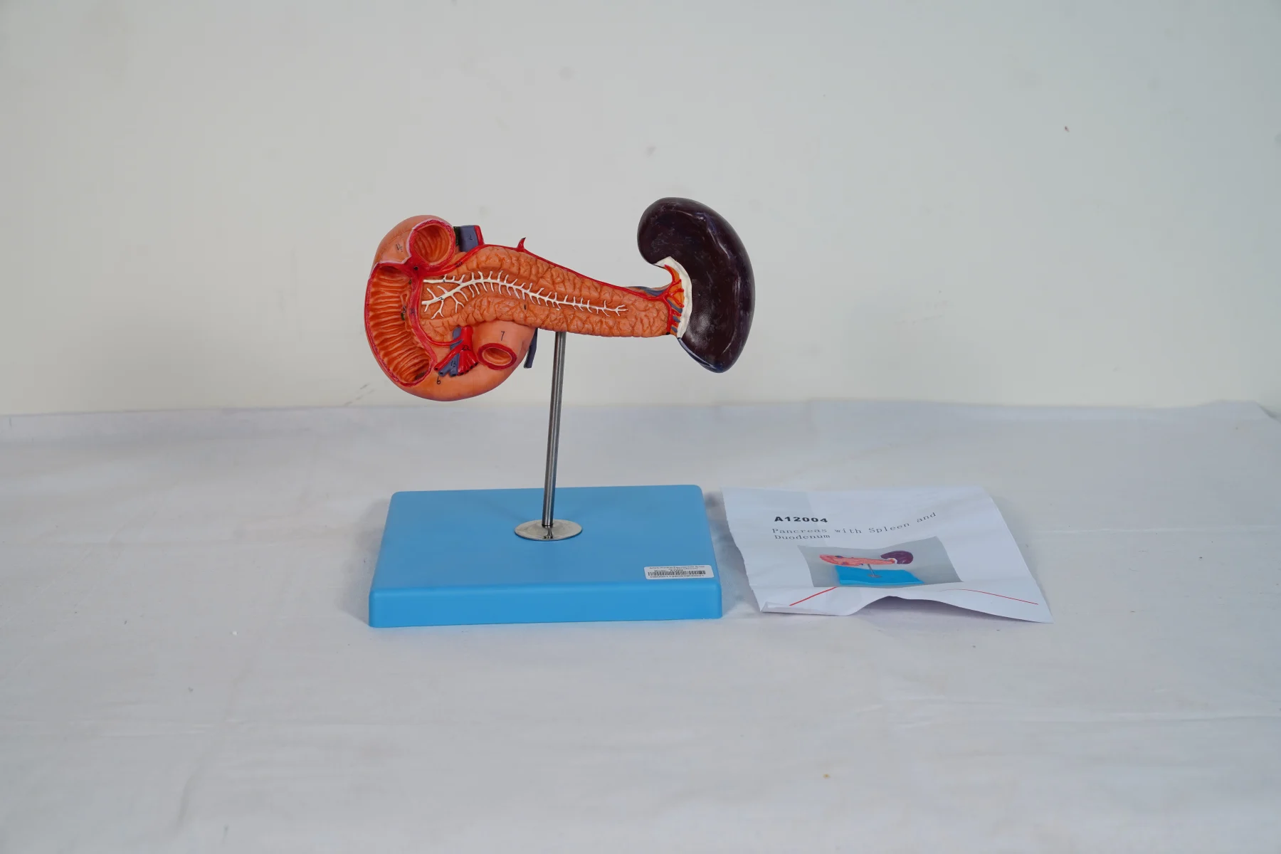 Pancreas With Spleen and Duodenum