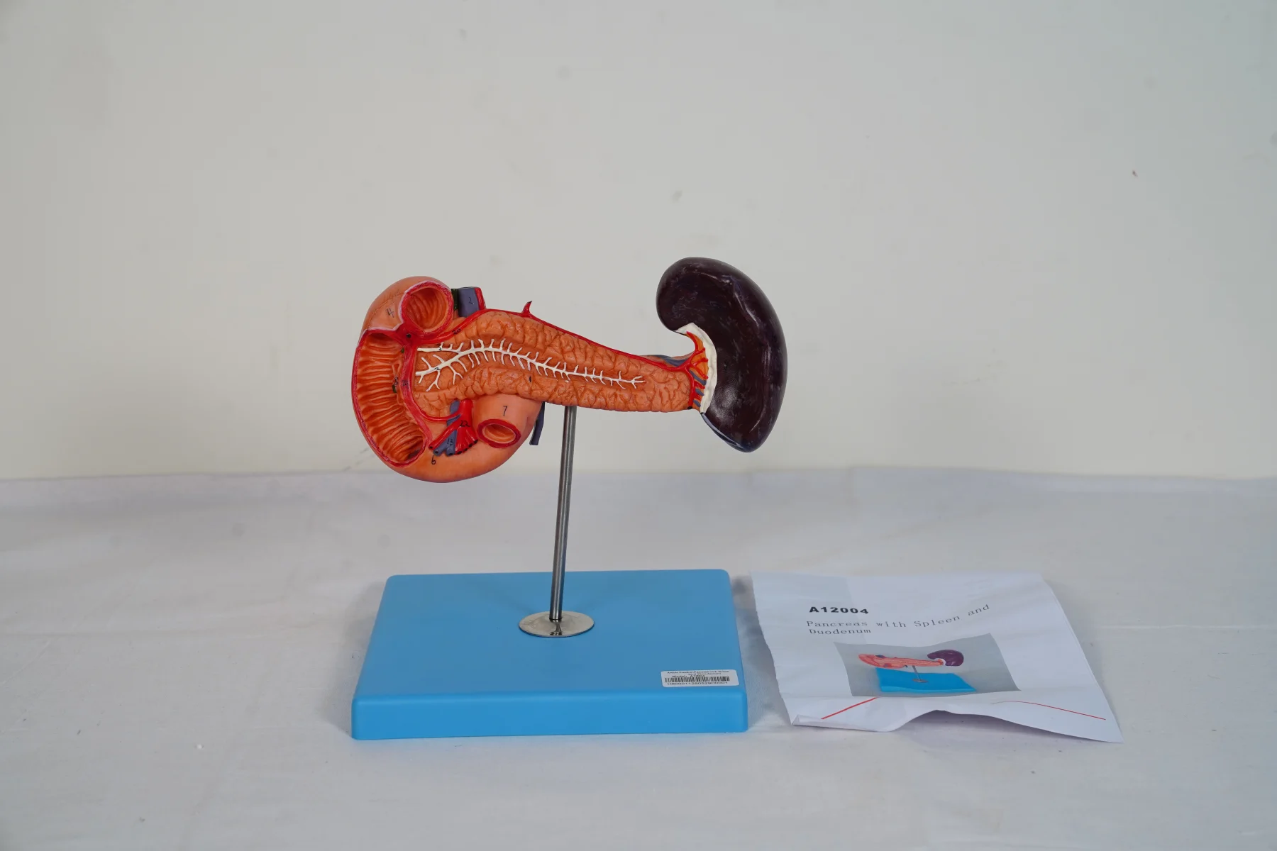 Pancreas With Spleen and Duodenum thumbnail 2