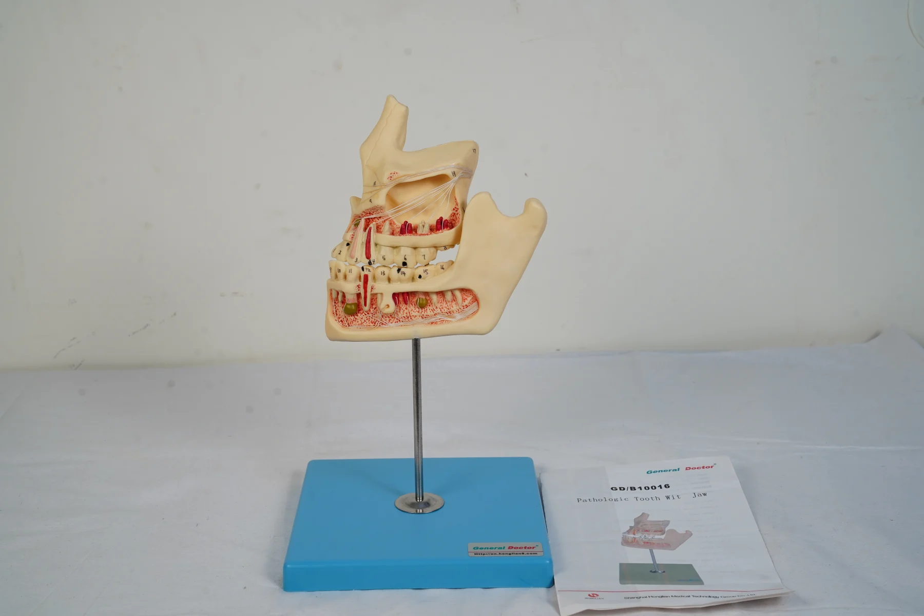 Pathologic Tooth With Jaw