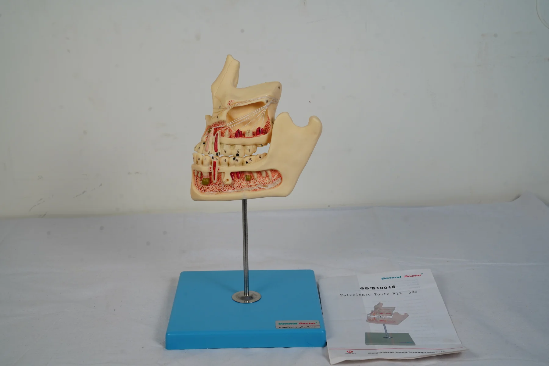 Pathologic Tooth With Jaw thumbnail 2