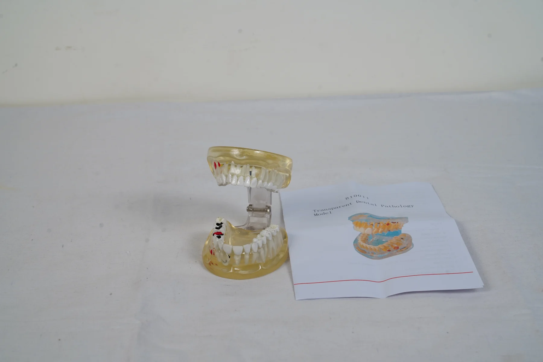Transparent Dental Pathology Model thumbnail 7