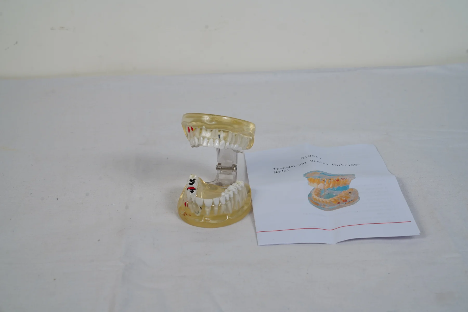 Transparent Dental Pathology Model