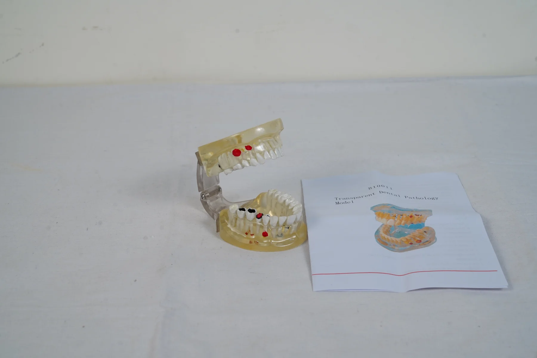 Transparent Dental Pathology Model thumbnail 2