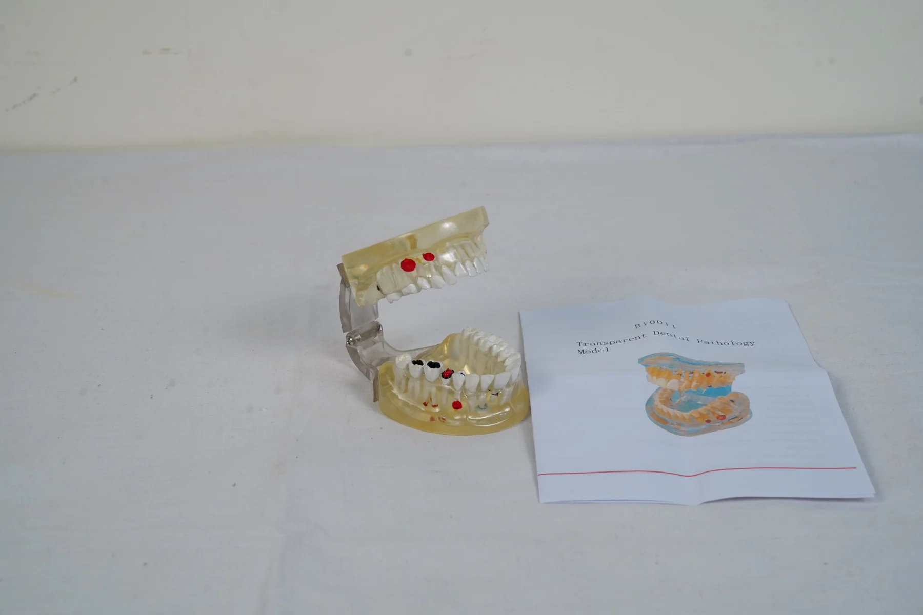 Transparent Dental Pathology Model thumbnail 3