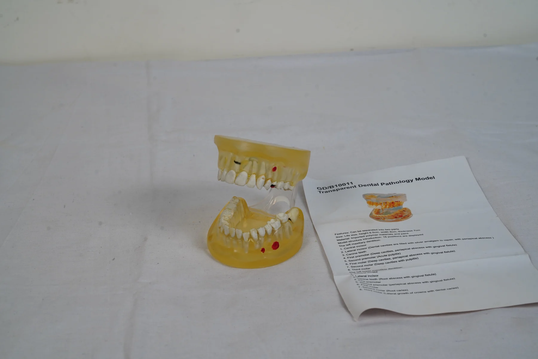 Transparent Dental Pathology Model thumbnail 4