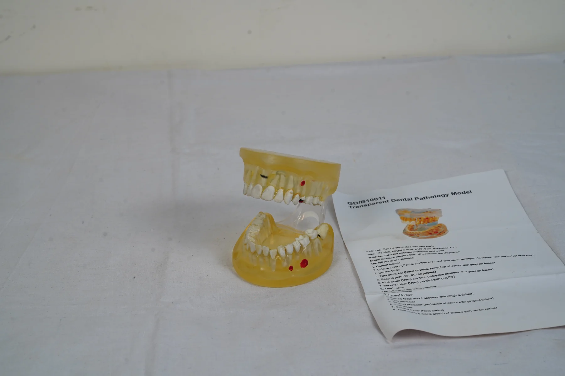Transparent Dental Pathology Model thumbnail 5