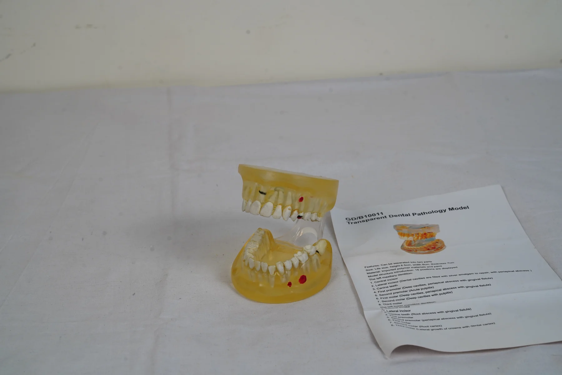 Transparent Dental Pathology Model thumbnail 6