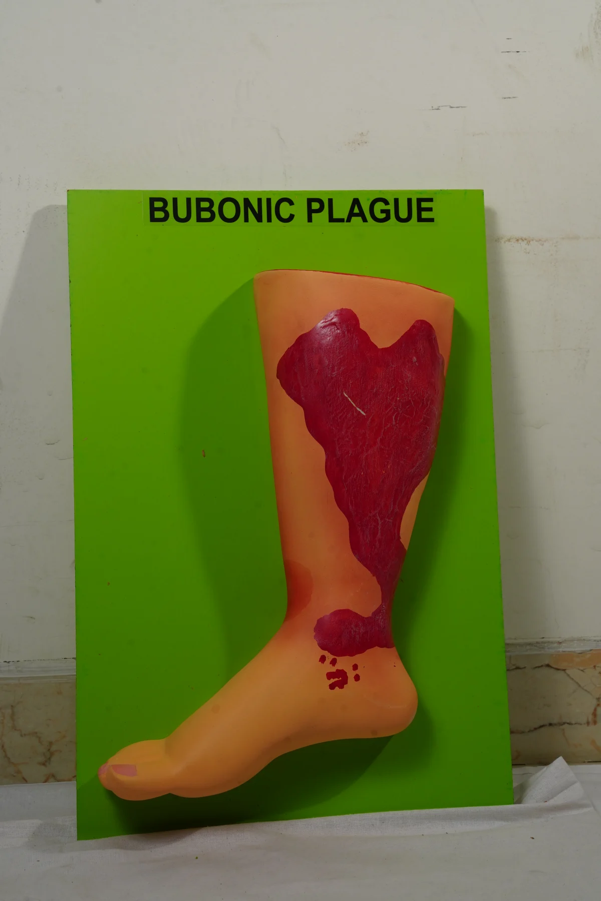 Bubonic Plague