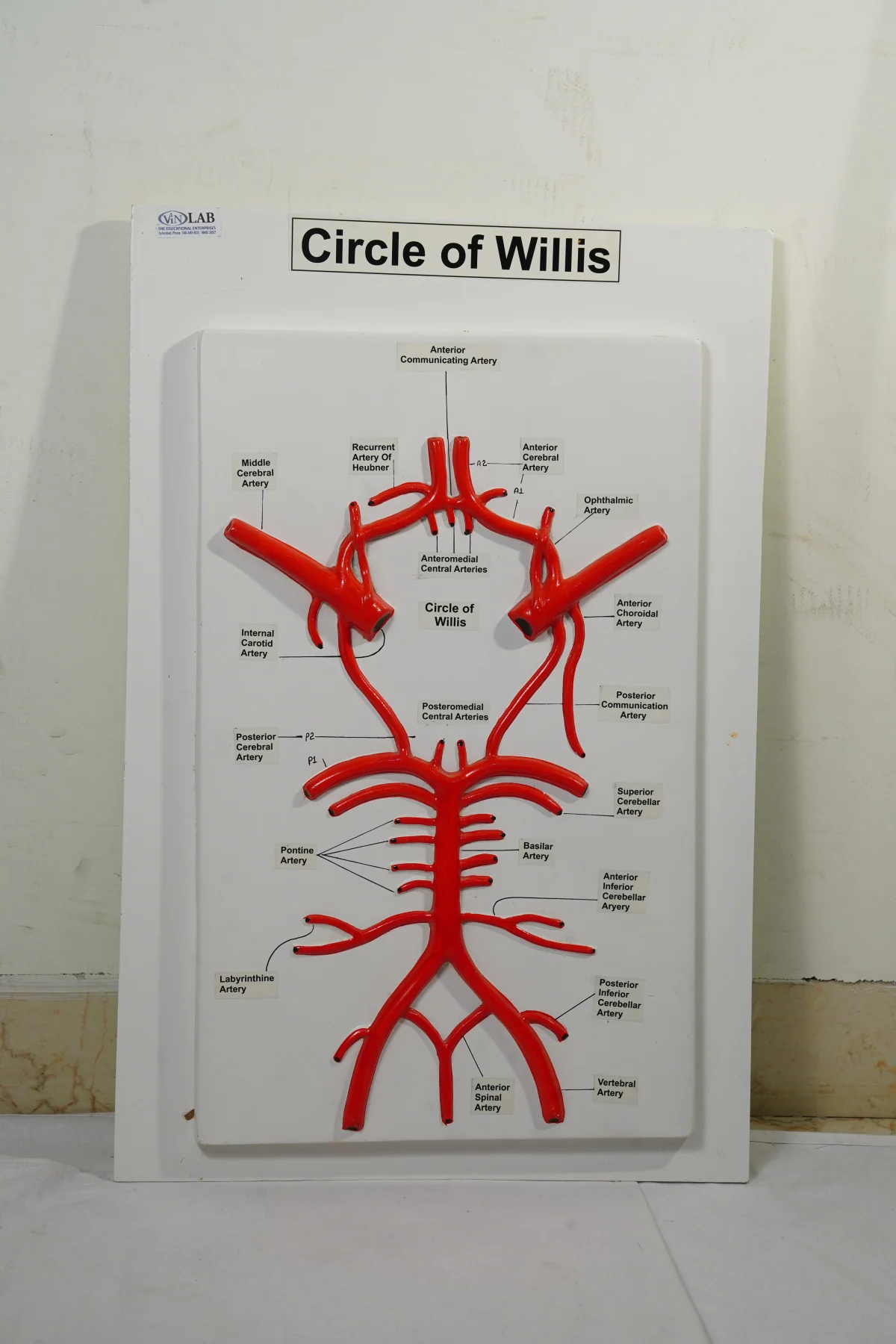 Circle of Willis thumbnail 3