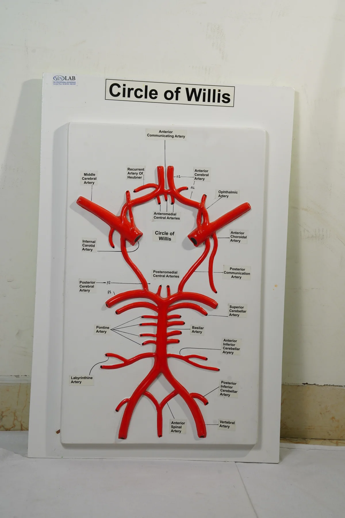 Circle of Willis