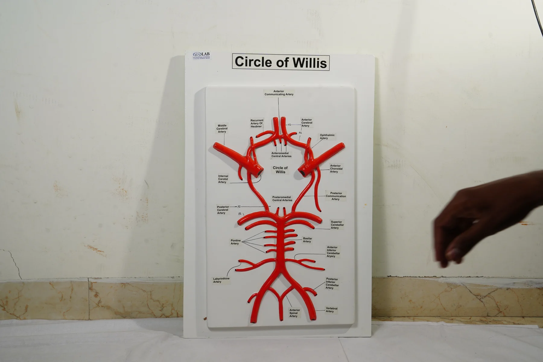 Circle of Willis thumbnail 2