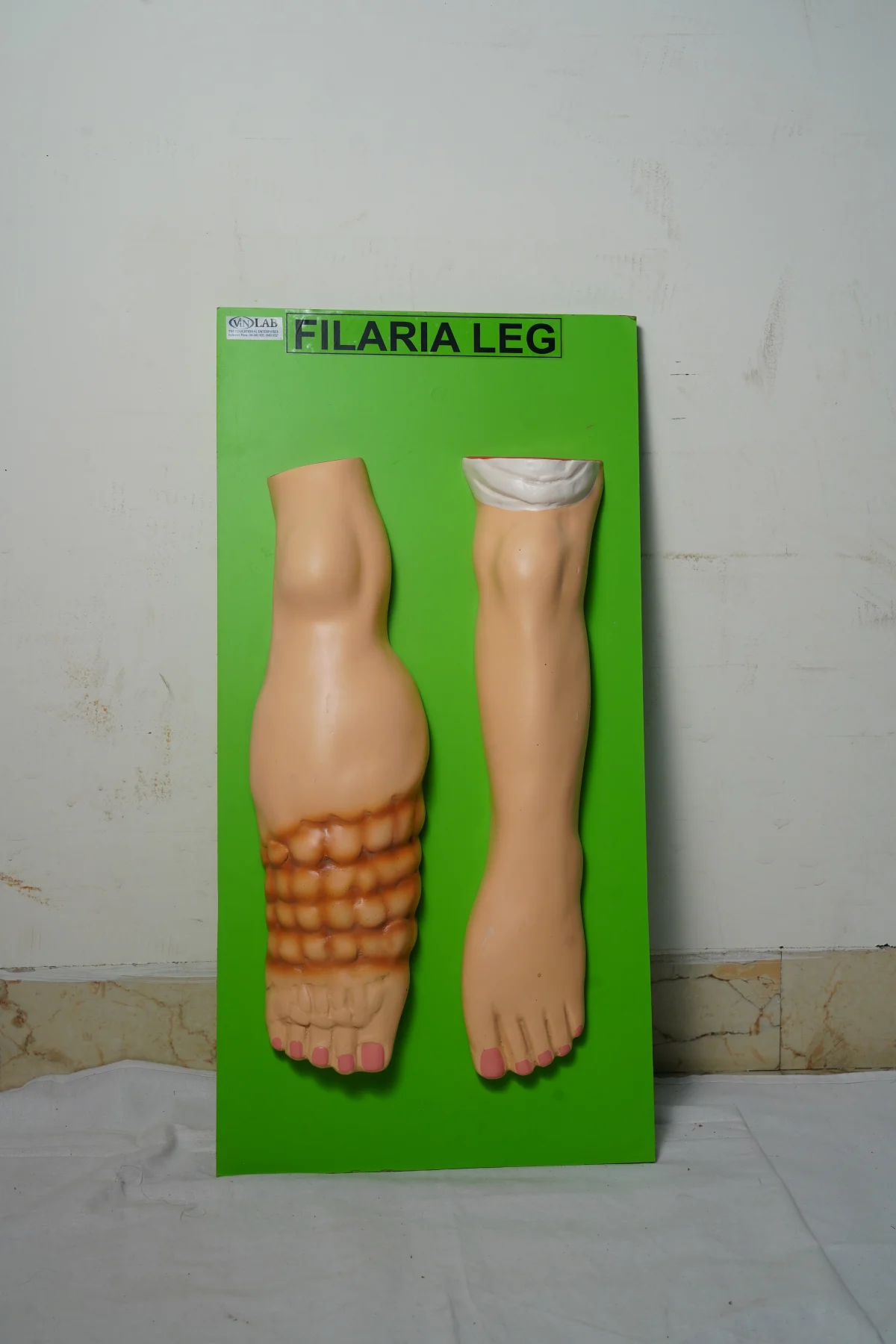 Filaria Leg