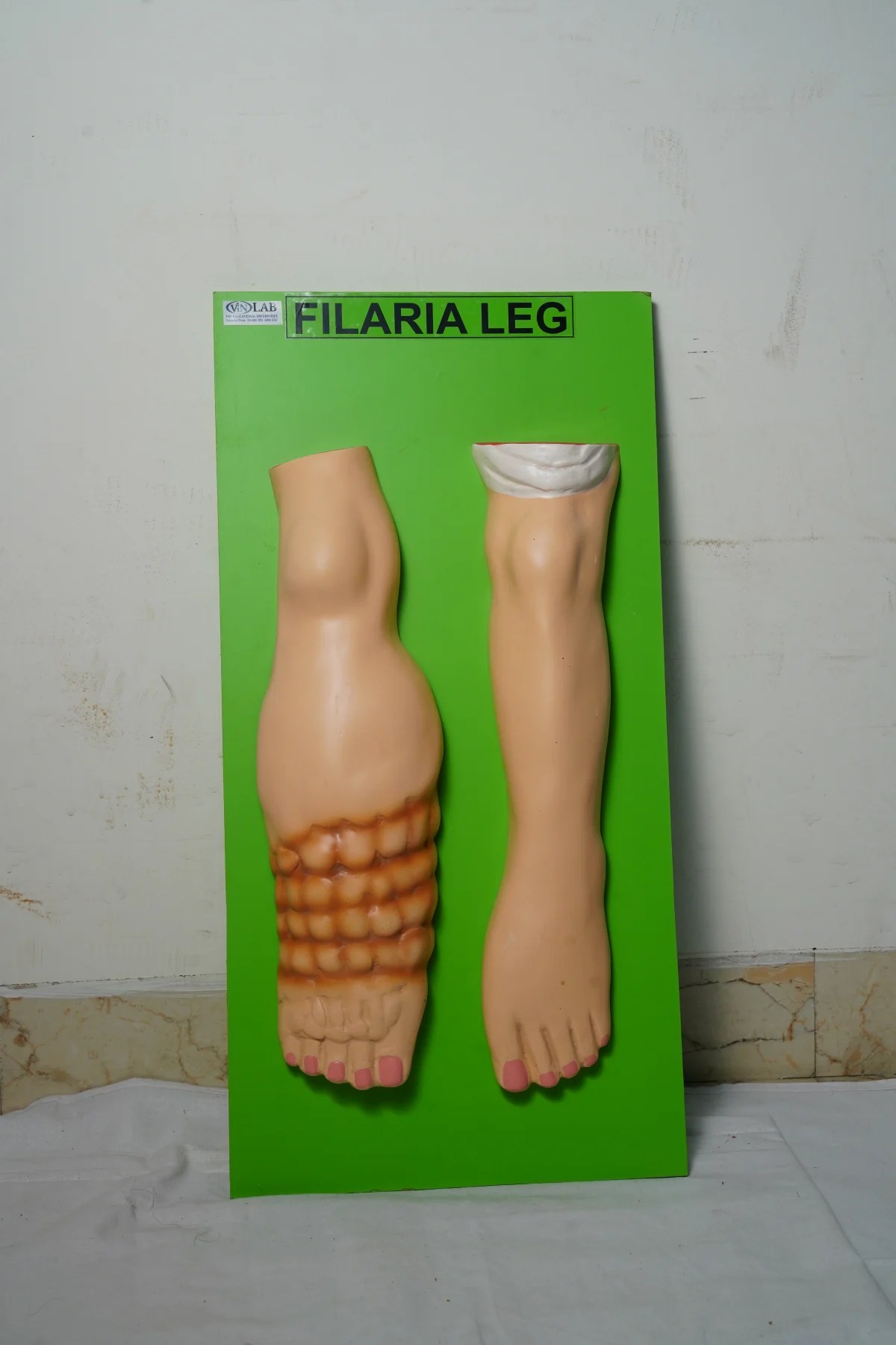 Filaria Leg thumbnail 2