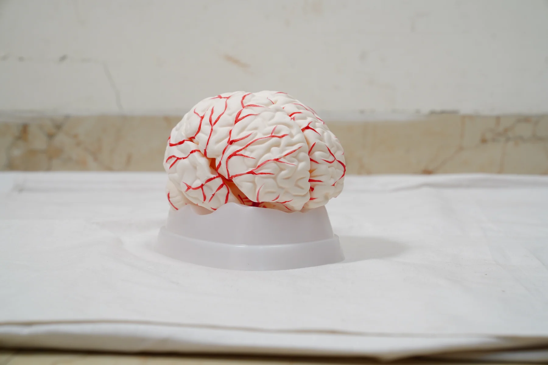 Model of The Brain and Arterial Supply thumbnail 4