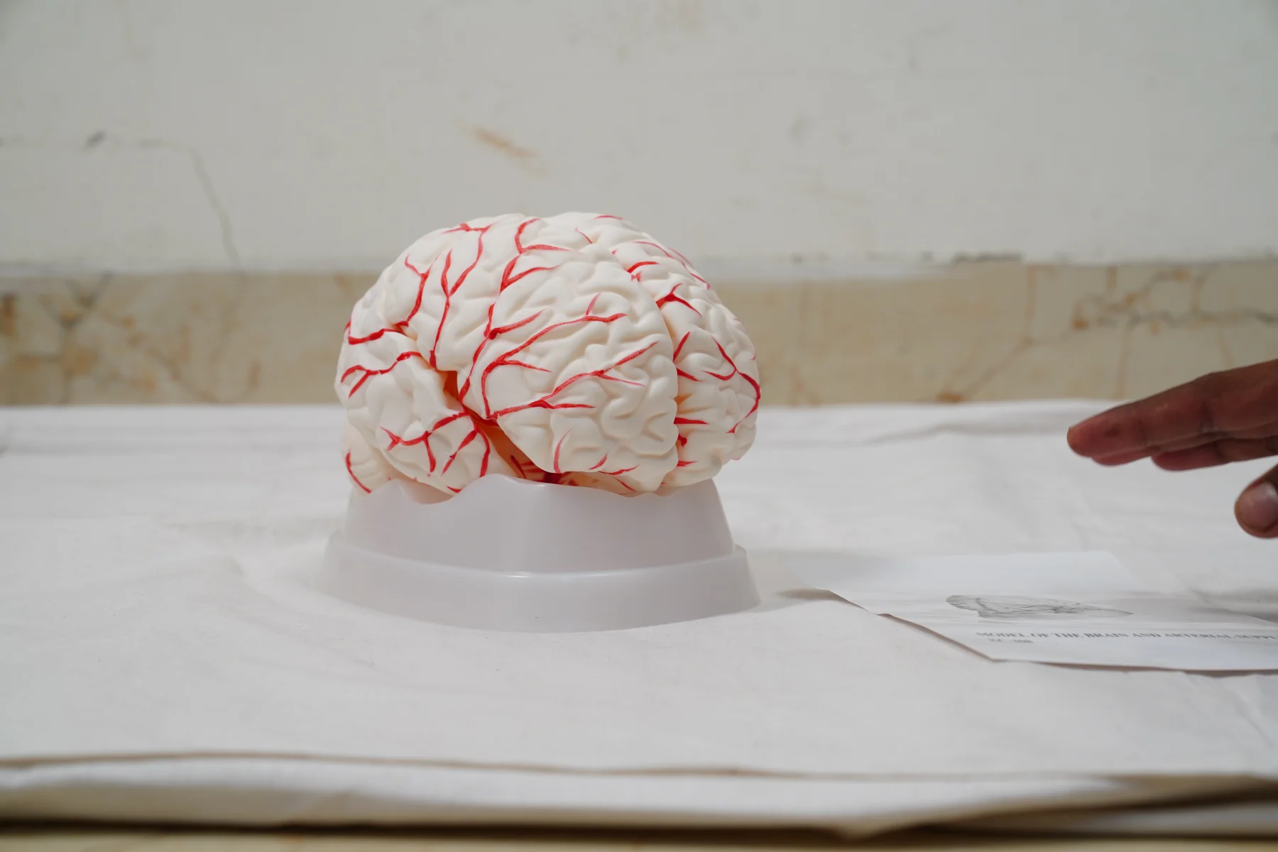 Model of The Brain and Arterial Supply