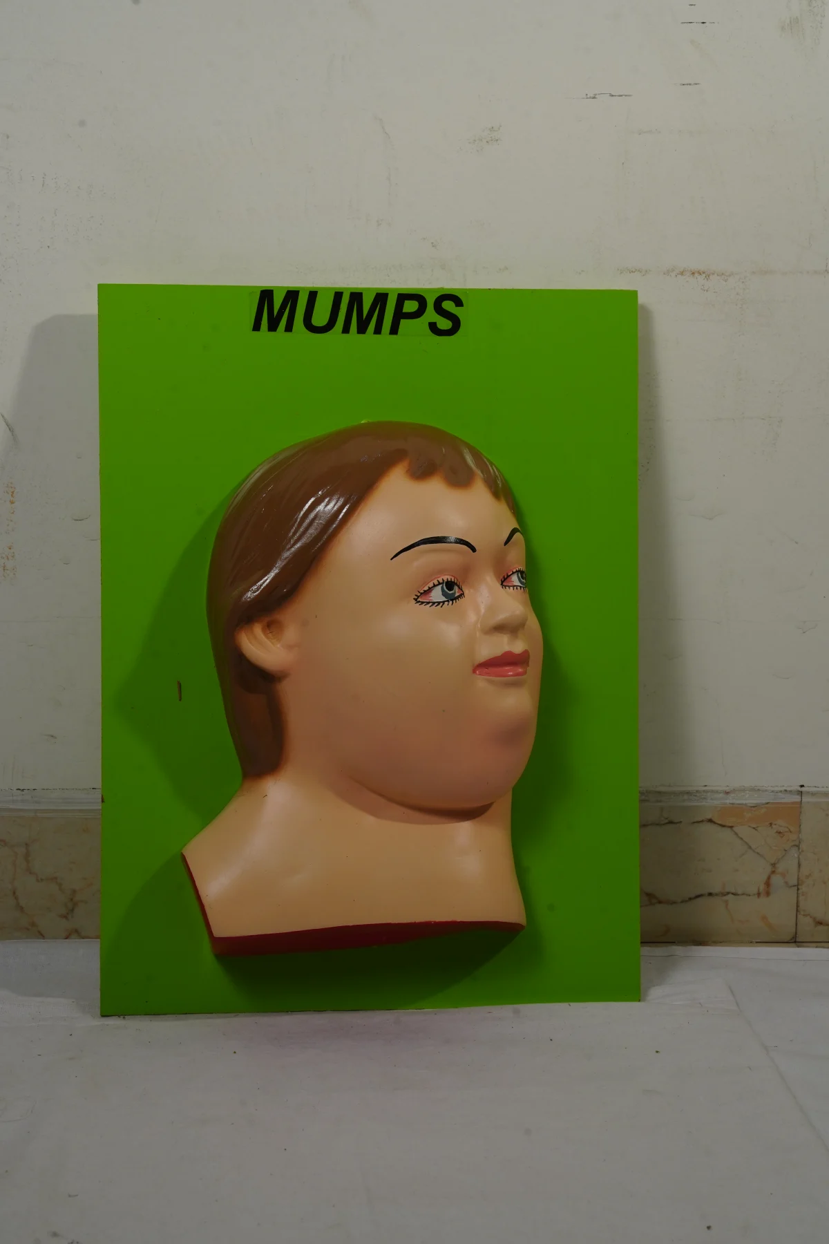 Mumps
