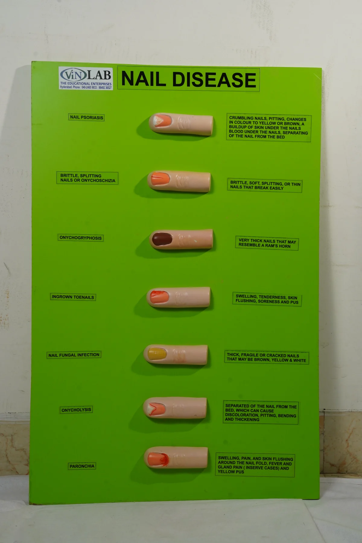 Nail Disease thumbnail 2