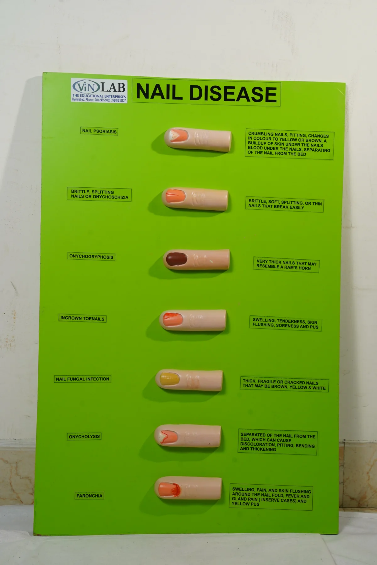 Nail Disease