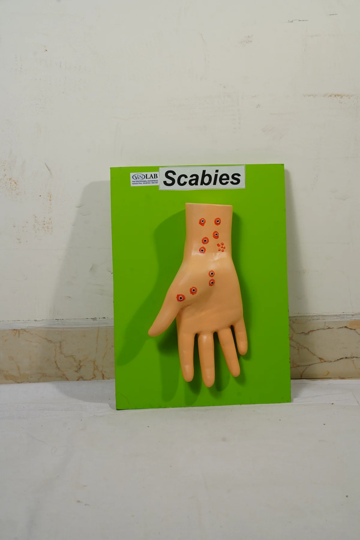 Scabies thumbnail 2