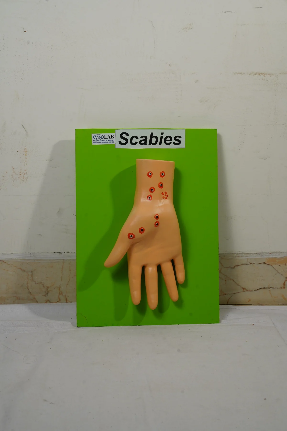 Scabies