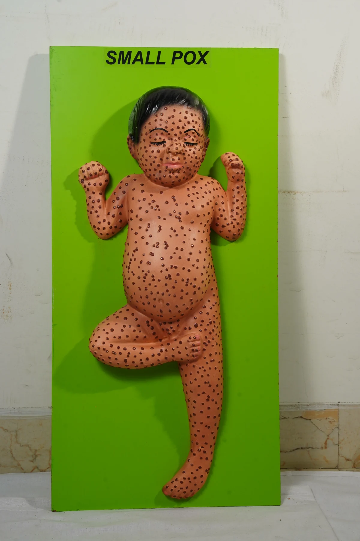 Small Pox