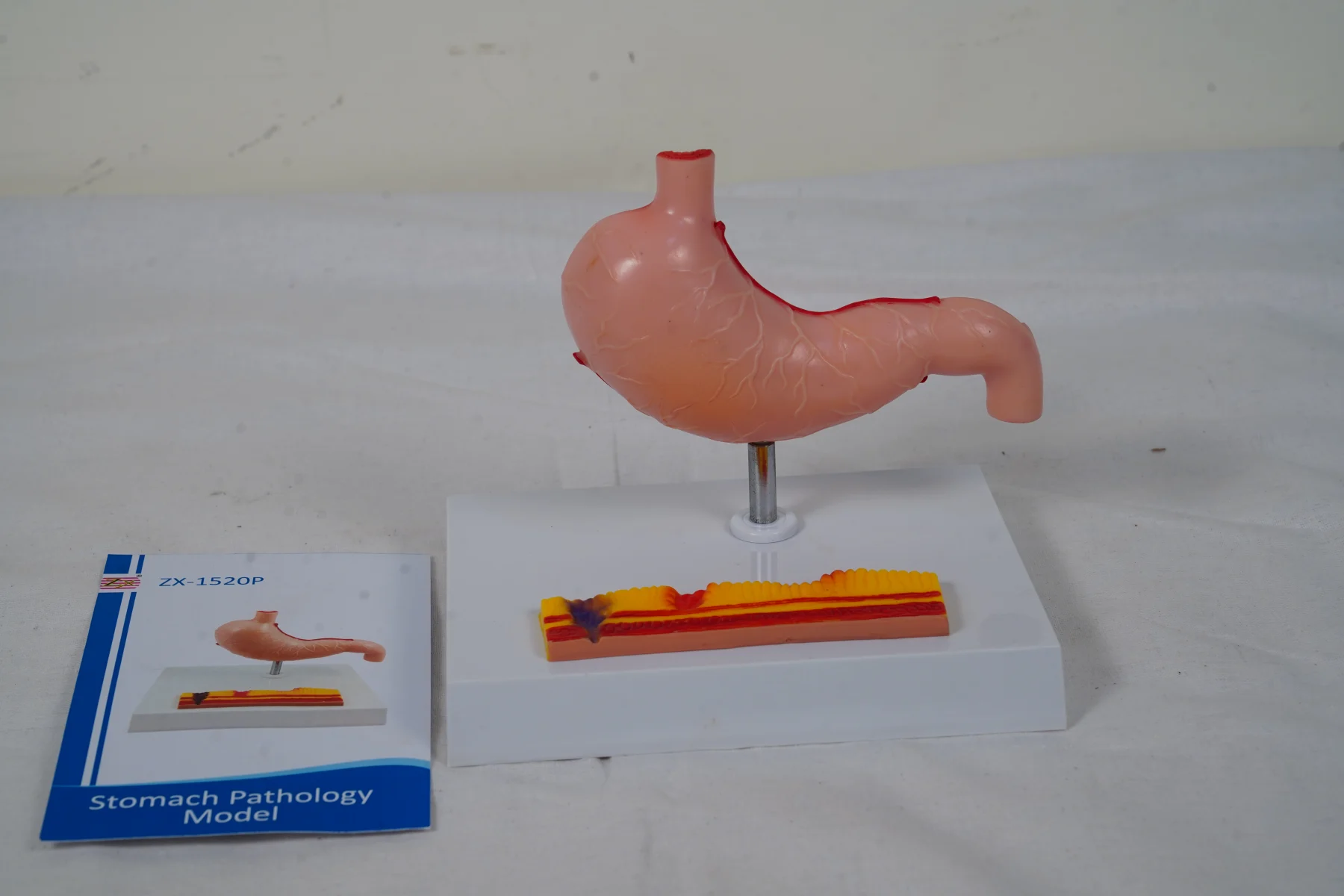 Stomach Pathology Model thumbnail 7