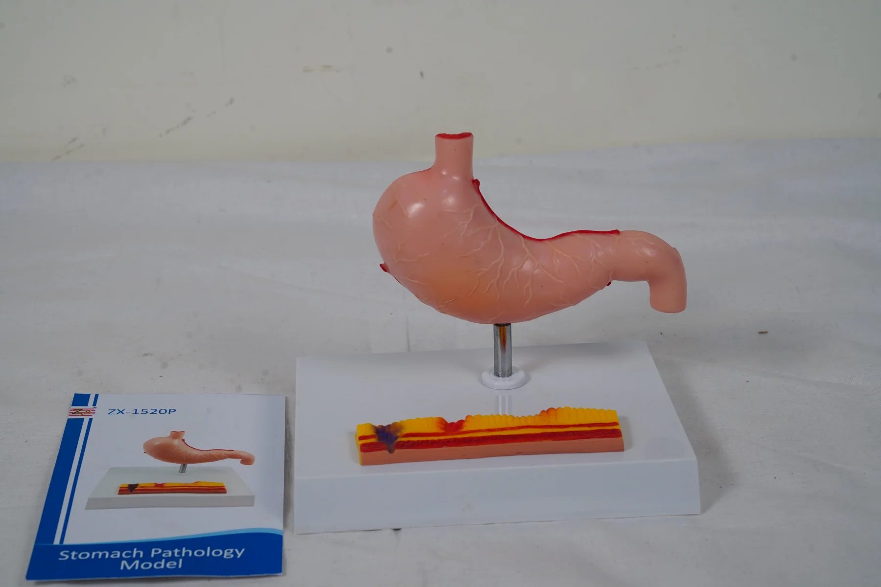 Stomach Pathology Model