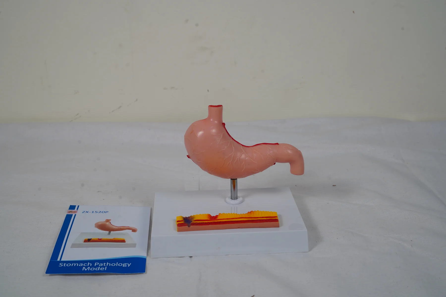 Stomach Pathology Model thumbnail 2