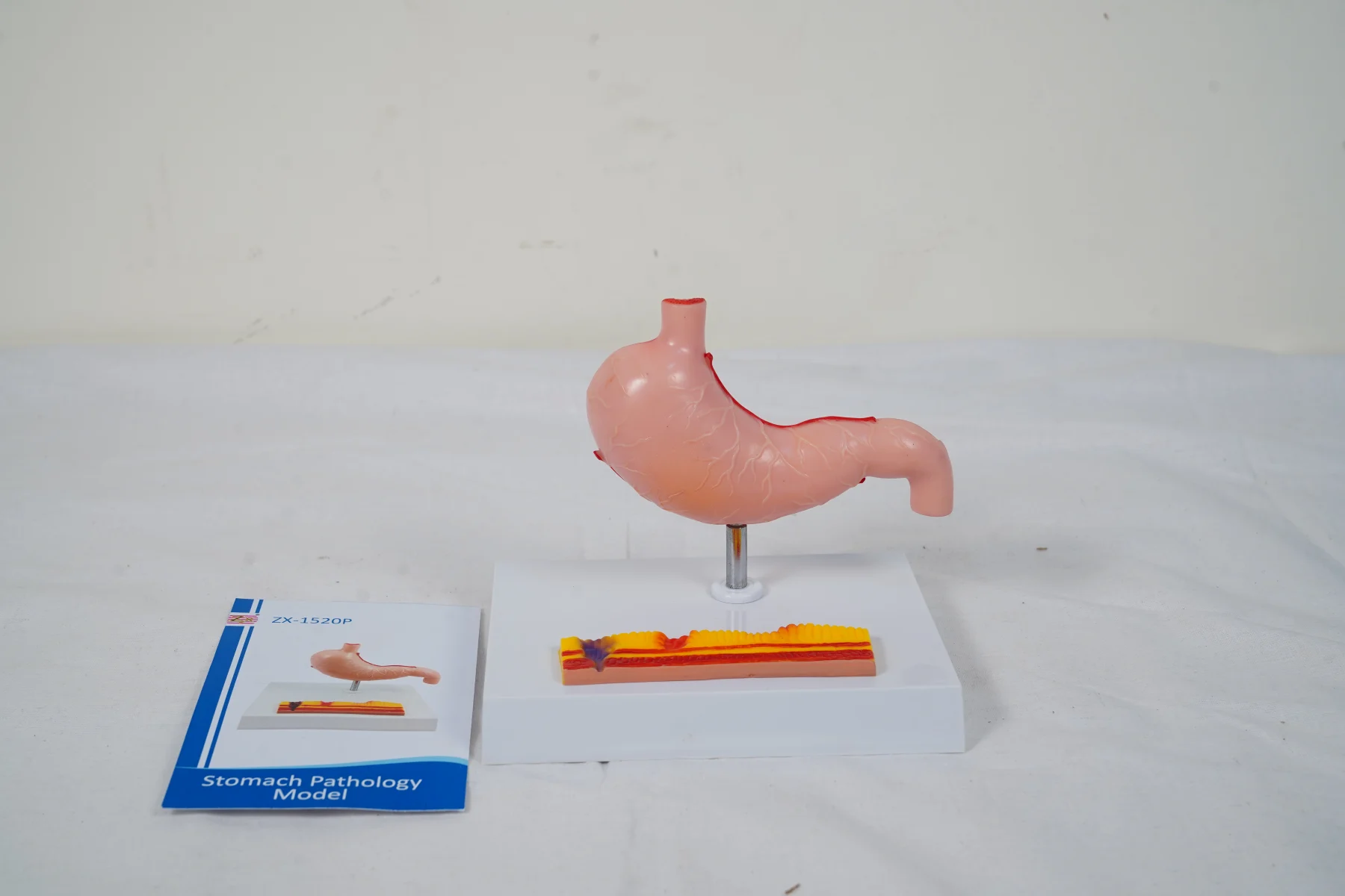 Stomach Pathology Model thumbnail 3
