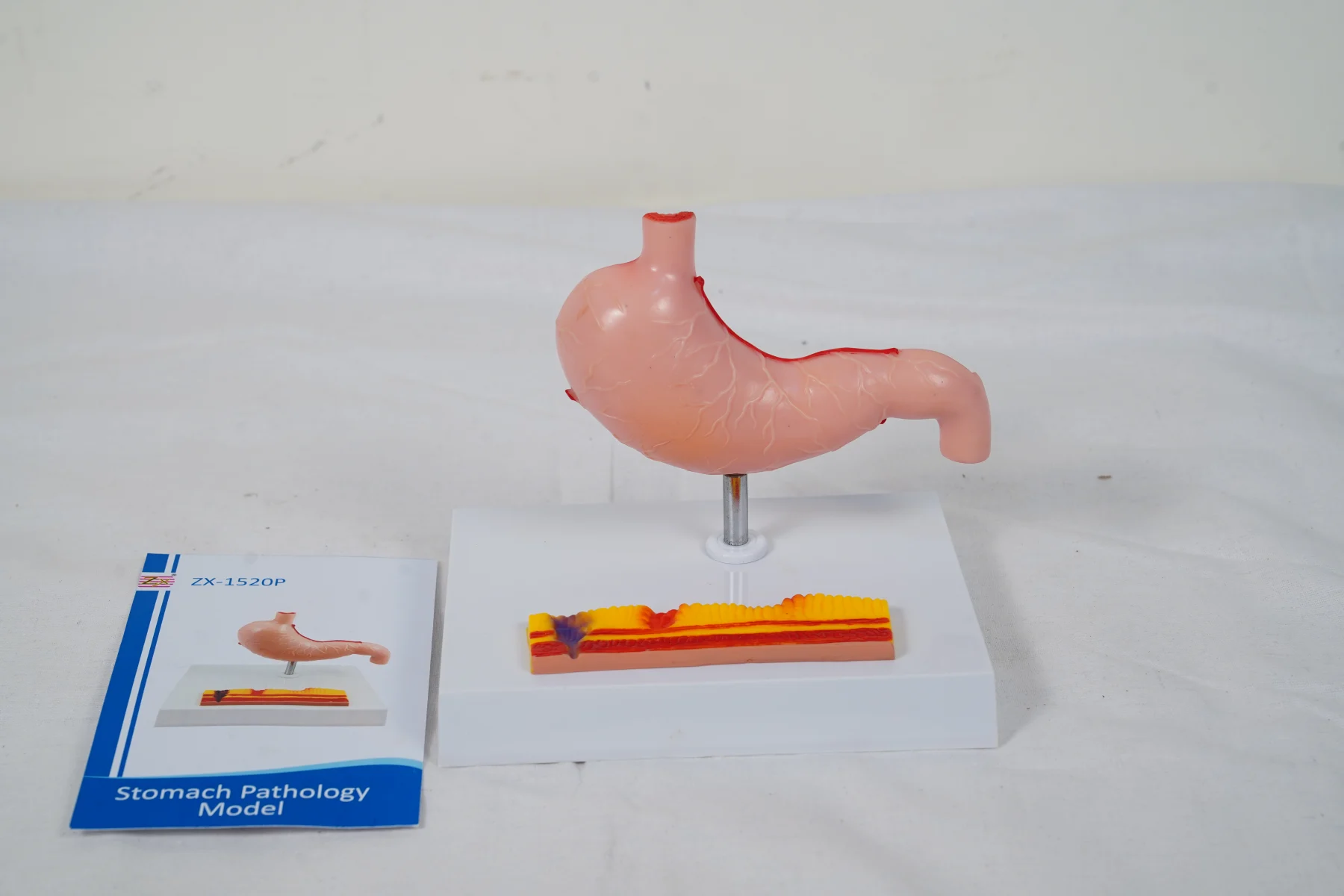 Stomach Pathology Model thumbnail 4