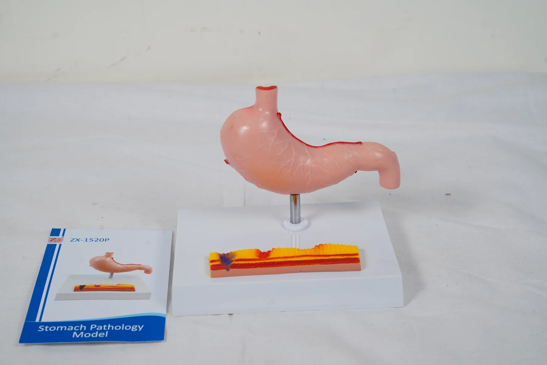 Stomach Pathology Model thumbnail 5