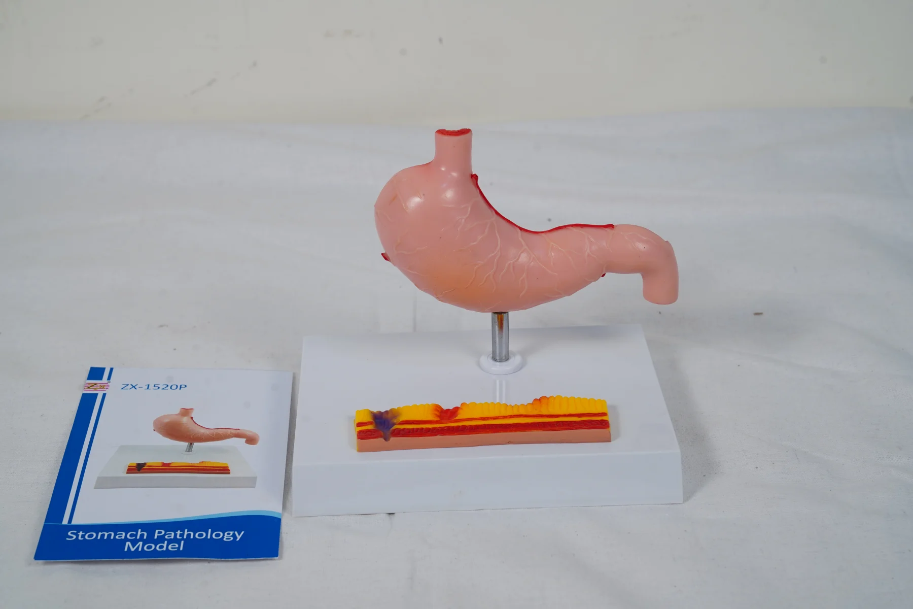 Stomach Pathology Model thumbnail 6