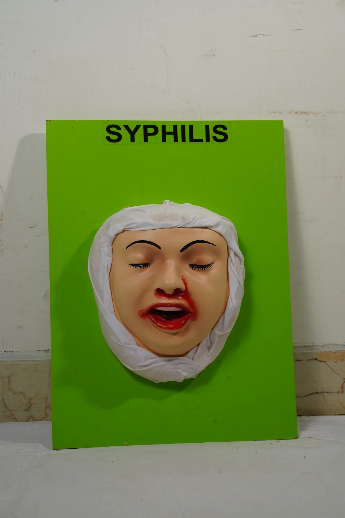 Syphilis