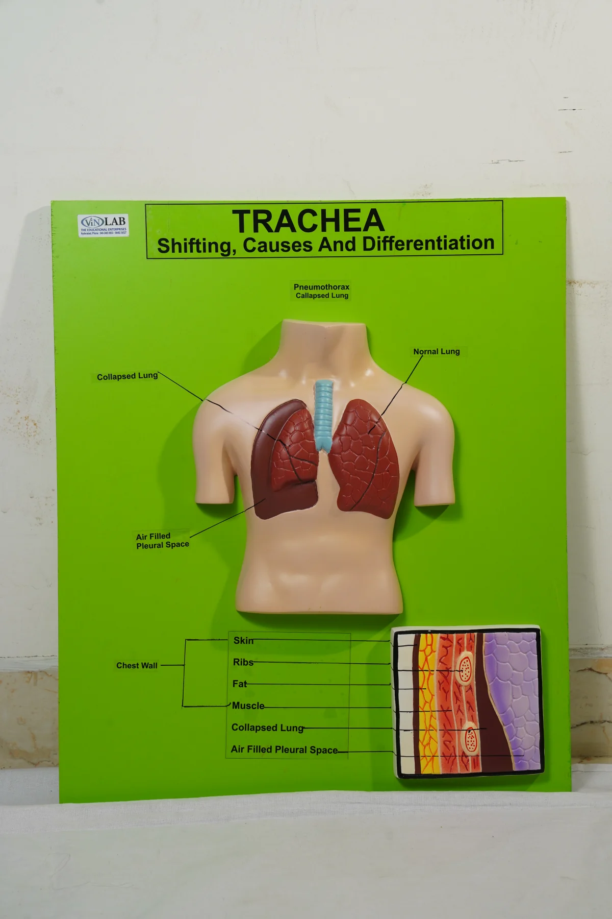 Trachea thumbnail 3