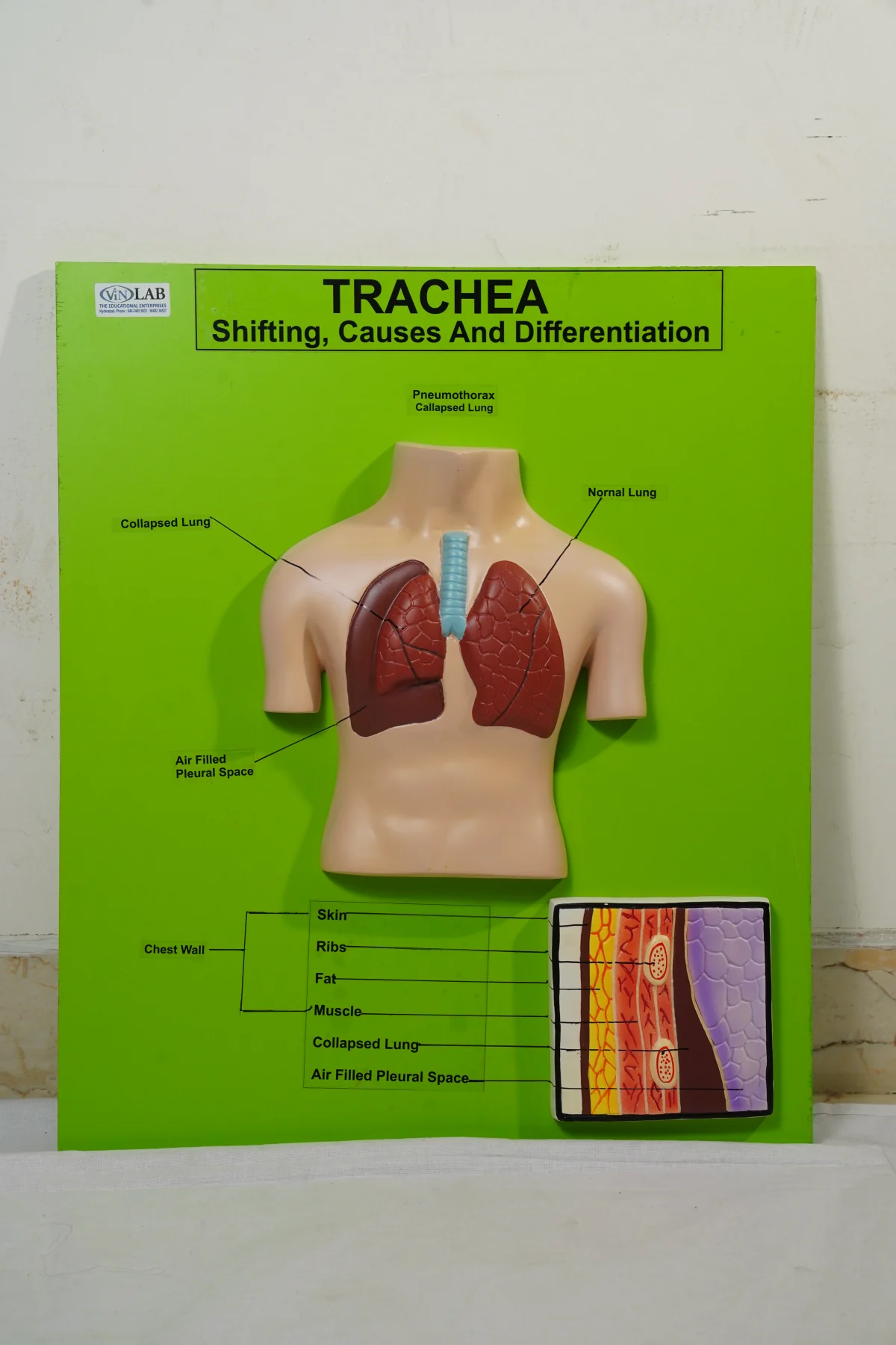Trachea
