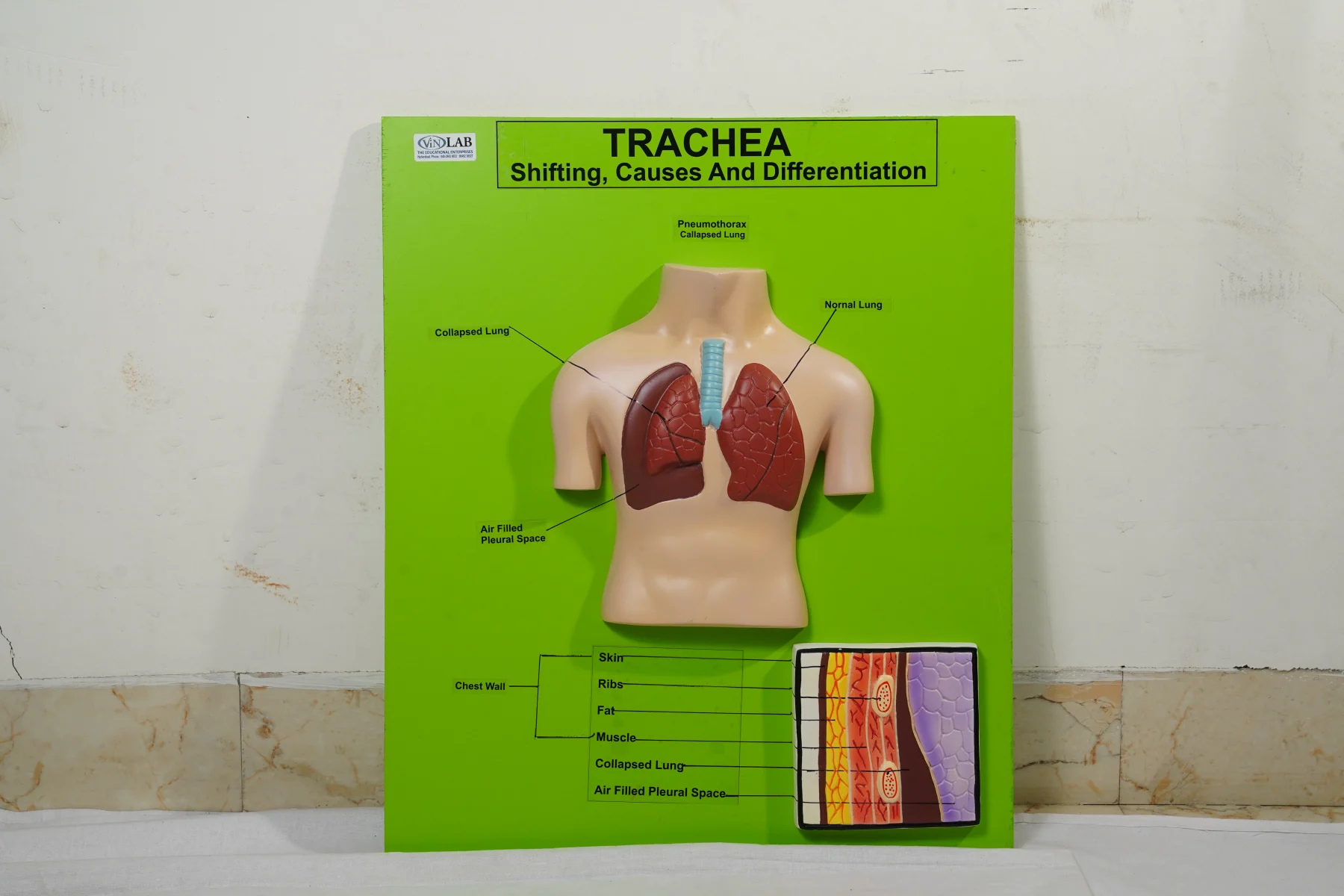 Trachea thumbnail 2