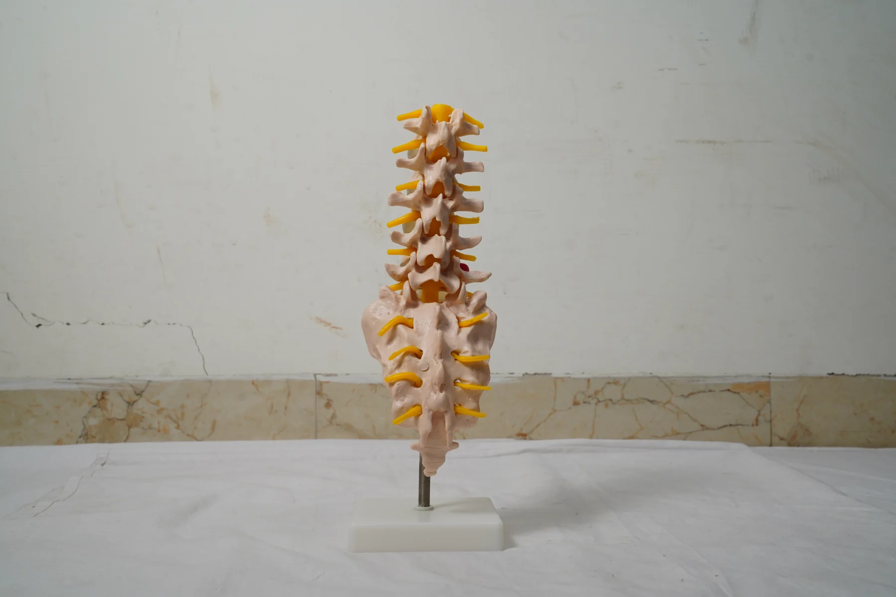 Life Size Lumbar Vertebrae With Sacrum Coccyx and Herniated Disc