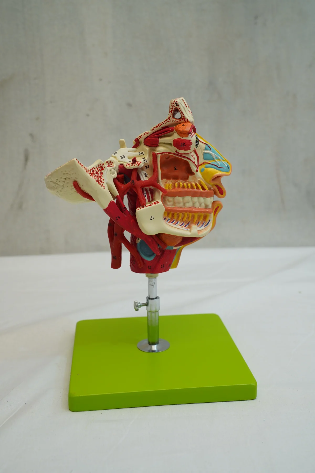 Nerves and Blood Vessels in the Facial Skull thumbnail 4